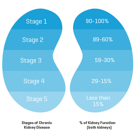 Graphic showing the different stages of CKD and declining kidney function